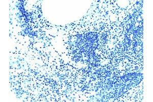 Cells treated with a phosphatase to eliminate all phosphorylation (PDGFRB 抗体  (pTyr857))
