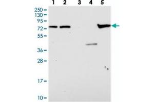 Western blot analysis of Lane 1: RT-4, Lane 2: U-251 MG, Lane 3: Human Plasma, Lane 4: Liver, Lane 5: Tonsil with KBTBD8 polyclonal antibody . (KBTBD8 抗体)