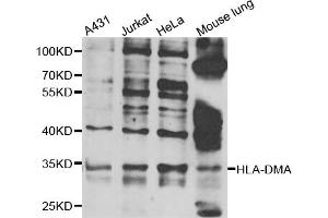 Western blot analysis of extracts of various cell lines, using HLA-DMA antibody (ABIN5975269) at 1/1000 dilution. (HLA-DMA 抗体)