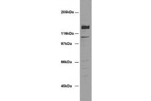 Image no. 1 for anti-Desmoglein 2 (DSG2) (AA 37-164) antibody (ABIN1742581) (Desmoglein 2 抗体  (AA 37-164))