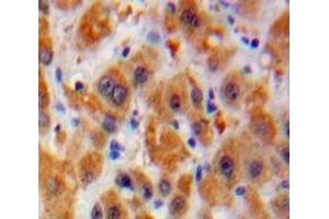 #VALUE! (Laminin alpha 5 抗体  (AA 3517-3718))