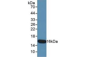 WB of Protein Standard: different control antibodies against Highly purified E. (KRT15 ELISA 试剂盒)