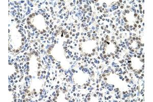 PRMT5 antibody was used for immunohistochemistry at a concentration of 4-8 ug/ml to stain Alveolar ceils (arrows) in Human Lung. (PRMT5 抗体  (N-Term))