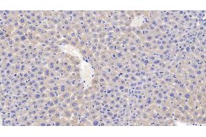 Detection of C1INH in Mouse Liver Tissue using Polyclonal Antibody to Complement 1 Inhibitor (C1INH)