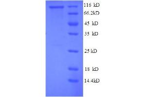 SDS-PAGE (SDS) image for phosphorylase, Glycogen, Liver (PYGL) (AA 2-846), (partial) protein (His tag) (ABIN5713776)