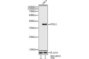 Western blot analysis of extracts of HeLa cells, using FOSL1 antibody (ABIN6131653, ABIN6140738, ABIN6140739 and ABIN6221016) at 1:1000 dilution. (FOSL1 抗体  (AA 1-100))