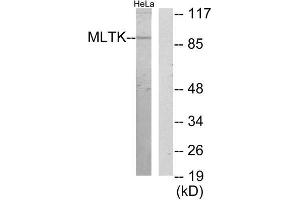 Western Blotting (WB) image for anti-Mitogen-Activated Protein Kinase Kinase Kinase MLT (ZAK) (C-Term) antibody (ABIN1850018) (ZAK 抗体  (C-Term))
