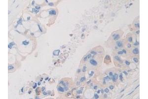 Immunohistochemistry (IHC) image for anti-Pyruvate Dehydrogenase Complex, Component X (PDHX) (AA 220-468) antibody (ABIN7443305)
