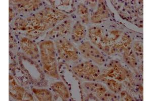 Immunohistochemistry (IHC) image for anti-Plasminogen Activator Inhibitor 1 (SERPINE1) antibody (ABIN7127662)