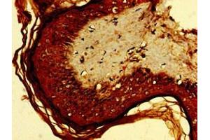 Immunohistochemistry of paraffin-embedded human skin tissue using ABIN7167795 at dilution of 1:100 (Retinoic Acid Early Transcript 1E (RAET1E) (AA 31-225) 抗体)