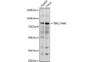 Western blot analysis of extracts of various cell lines, using TBK1/NAK antibody (ABIN3016267, ABIN3016268, ABIN3016269 and ABIN6219678) at 1:1000 dilution.