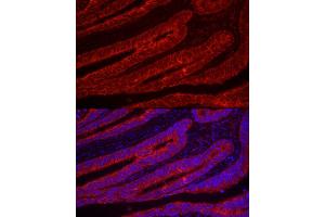 Immunofluorescence analysis of human colon carcinoma using TFF3 Rabbit pAb (ABIN6128142, ABIN6149051, ABIN6149052 and ABIN6219136) at dilution of 1:100 (40x lens). (TFF3 抗体  (AA 22-94))