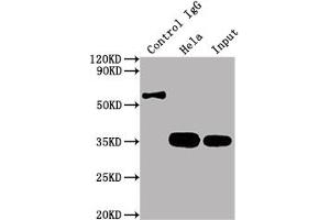 Immunoprecipitating CDK4 in Hela whole cell lysate Lane 1: Rabbit control IgG instead of ABIN7127418 in Hela whole cell lysate. (Recombinant CDK4 抗体)