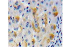IHC-P analysis of Liver tissue, with DAB staining. (MMP15 抗体  (AA 336-539))