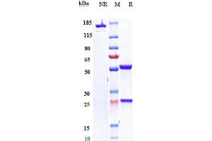 Anti- Human CLDN18. (Recombinant CLDN18.2 (Zolbetuximab Biosimilar) 抗体)