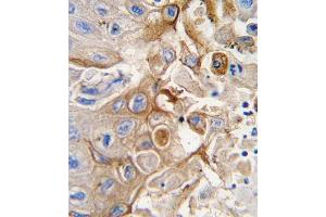 Immunohistochemistry (Paraffin-embedded Sections) (IHC (p)) image for anti-Cytochrome P450, Family 2, Subfamily W, Polypeptide 1 (CYP2W1) (AA 7-33), (N-Term) antibody (ABIN392221)
