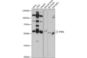 Western blot analysis of extracts of various cell lines, using IP6K1 antibody (ABIN6131922, ABIN6142500, ABIN6142501 and ABIN6215821) at 1:1000 dilution. (IP6K1 抗体  (AA 1-220))