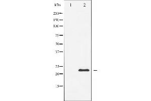 Western blot analysis of Caveolin-1 expression in NIH-3T3 whole cell lysates,The lane on the left is treated with the antigen-specific peptide. (Caveolin-1 抗体  (N-Term))