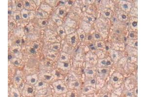 DAB staining on IHC-P; Samples: Human Liver Tissue (IL-4 抗体  (AA 25-153))