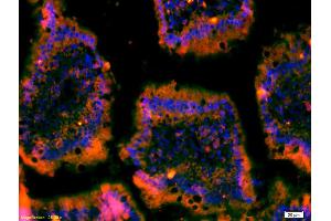 Formalin-fixed and paraffin-embedded mouse intestine labeled with Anti-C-Met/Met/HGFR Polyclonal Antibody, Unconjugated (ABIN671661) 1:200, overnight at 4°C, The secondary antibody was Goat Anti-Rabbit IgG, Cy3 conjugated used at 1:200 dilution for 40 minutes at 37°C. (c-MET 抗体  (AA 25-150))
