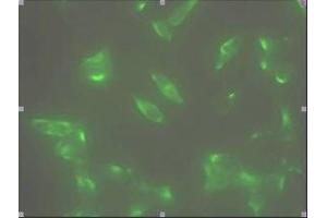 Immunofluorescence staining of human LNCap cell colony with monoclonal anti- human STEAP1 antibody. (STEAP1 抗体  (AA 1-70))