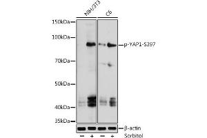 Western blot analysis of extracts of various cell lines, using phospho-Y-S397 antibody (ABIN7271417) at 1:1000 dilution.