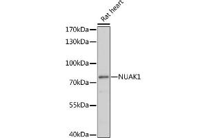 Western blot analysis of extracts of rat heart, using NU antibody (ABIN7268966) at 1:1000 dilution. (NUAK1 抗体  (AA 362-661))