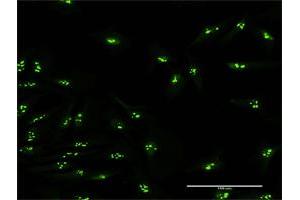 Immunofluorescence of purified MaxPab antibody to KIAA0020 on HeLa cell. (KIAA0020 抗体  (AA 1-648))