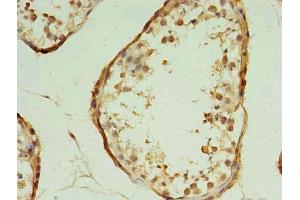 Immunohistochemistry of paraffin-embedded human testis tissue using ABIN7172357 at dilution of 1:100 (TRAPPC2L 抗体  (AA 1-139))