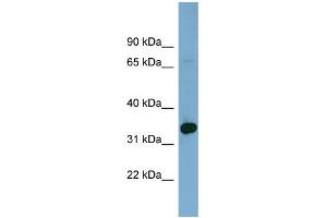 WB Suggested Anti-HOXD12 Antibody Titration: 0. (HOXD12 抗体  (Middle Region))