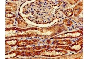 Immunohistochemistry of paraffin-embedded human kidney tissue using ABIN7153175 at dilution of 1:100 (FZD1 抗体  (AA 73-322))