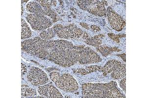 IHC analysis of TRMT6 using anti-TRMT6 antibody (ABIN7602138). (TRMT6 抗体  (AA 6-489))