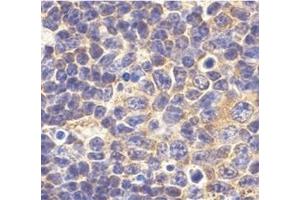 Immunohistochemistry of TLR1 in mouse spleen tissue with this product at 10 μg/ml. (TLR1 抗体  (N-Term))