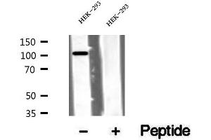 Western blot analysis of extracts of HEK-293 cells, using VPS11 antibody. (VPS11 抗体  (Internal Region))