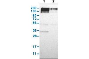 Western Blot analysis with PARP4 polyclonal antibody . (PARP4 抗体  (AA 247-392))