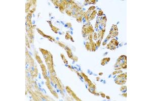Immunohistochemistry of paraffin-embedded mouse heart using COL9A3 antibody. (COL9A3 抗体)