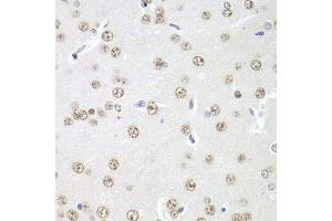 Immunohistochemistry of paraffin-embedded rat brain using PRMT5 antibody at dilution of 1:100 (x40 lens). (PRMT5 抗体)