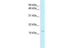WB Suggested Anti-Stmn1 Antibody Titration: 1. (Stathmin 1 抗体  (N-Term))
