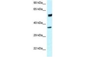 Image no. 1 for anti-Homer Homolog 3 (Drosophila) (HOMER3) (C-Term) antibody (ABIN6747696) (HOMER3 抗体  (C-Term))
