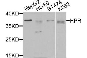 Western blot analysis of extracts of various cells, using HPR antibody. (HPR 抗体)