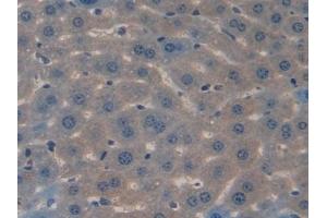 Immunohistochemistry (IHC) image for anti-Spondin 1 (SPON1) (AA 608-802) antibody (ABIN7440035)