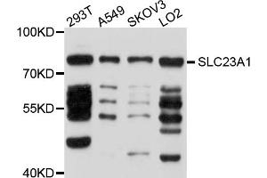 Western blot analysis of extracts of various cell lines, using SLC23A1 antibody (ABIN5998840) at 1/1000 dilution.