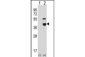 Western blot analysis of Cdk3 (arrow) using rabbit polyclonal Mouse Cdk3 Antibody (C-term) (ABIN657724 and ABIN2846710). (CDK3 抗体  (C-Term))