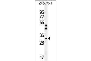 AREG Antibody (C-term) (ABIN392202 and ABIN2841903) western blot analysis in ZR-75-1 cell line lysates (35 μg/lane). (Amphiregulin 抗体  (C-Term))