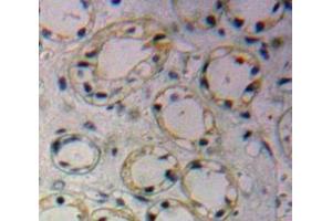 Immunohistochemistry (IHC) image for anti-Solute Carrier Family 2 (Facilitated Glucose Transporter), Member 1 (SLC2A1) (AA 251-329) antibody (ABIN7433228)