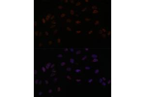anti-SMEK Homolog 2, Suppressor of Mek1 (Dictyostelium) (SMEK2) (AA 628-817) antibody