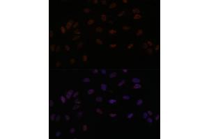 Immunofluorescence analysis of U-2 OS cells using PPP4R3B antibody (ABIN7270374) at dilution of 1:100. (SMEK2 抗体  (AA 628-817))