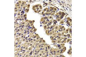 Immunohistochemistry of paraffin-embedded Rat stomach using CCT2 antibody at dilution of 1:100 (x400 lens).