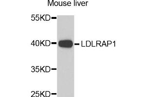 Western blot analysis of extracts of mouse liver, using LDLRAP1 antibody (ABIN5974266) at 1/1000 dilution. (LDLRAP1 抗体)