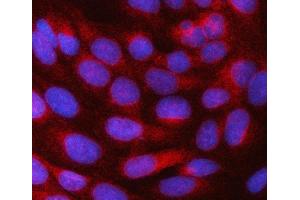 IF analysis of SRPRB using anti-SRPRB antibody (ABIN7602015). (SRPRB 抗体  (AA 55-271))